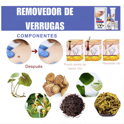 Compra HOY Wart Remove Cream y Recibe un Kit Completo!